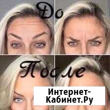 Модель на Ботокс Москва - изображение 1
