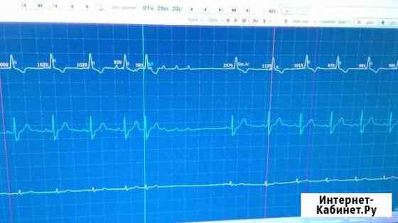 Репетиторство по электрокардиографии.экг.Холтер Байкит