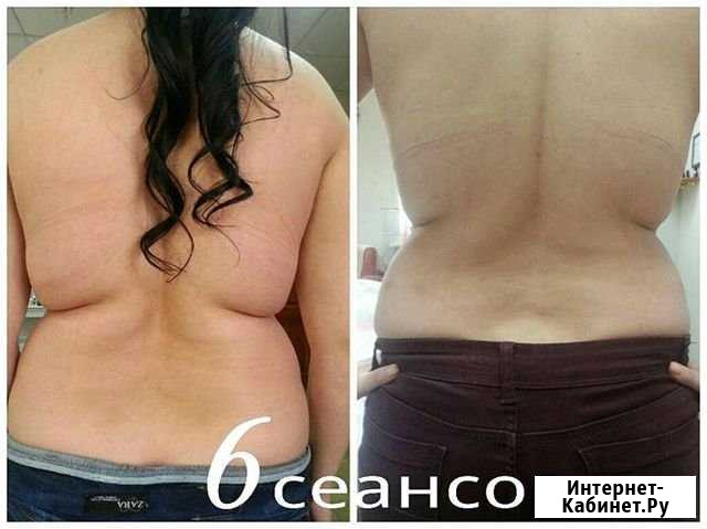 Массаж Зеленодольск - изображение 1
