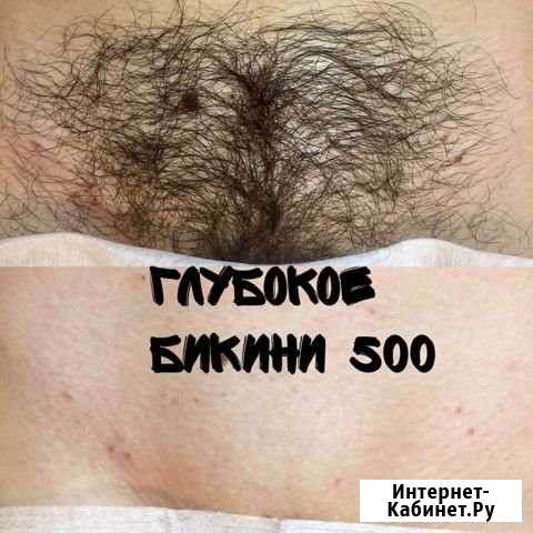 Шугаринг Астрахань - изображение 1