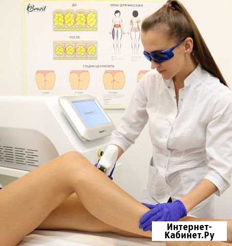 Лазерная эпиляция Красноярск - изображение 1
