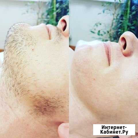 Шугаринг мужской женский Челябинск - изображение 1