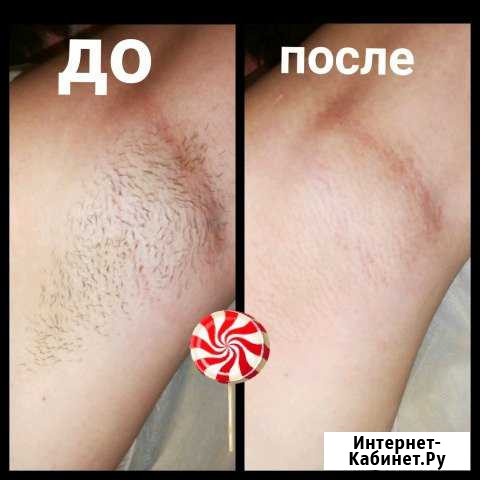 Шугаринг Автозавод Нижний Новгород - изображение 1