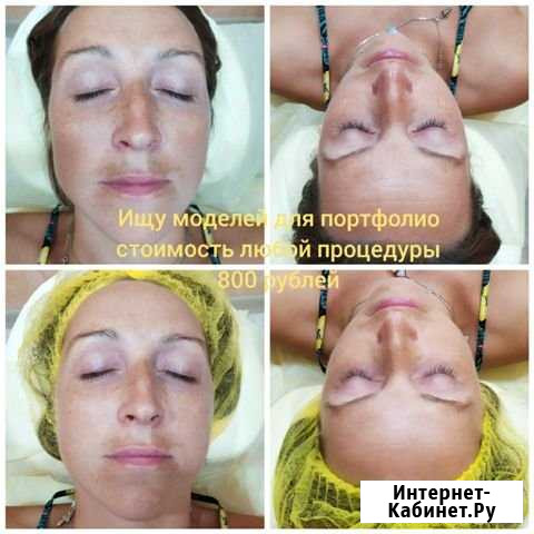 Аппаратная косметология Анапа - изображение 1