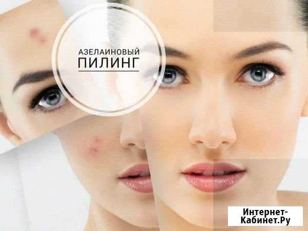 Азелаиновый пилинг Челябинск - изображение 1