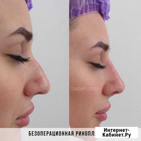 Косметолог Ставрополь - изображение 1