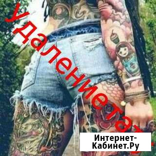 Удаление тату и татуажа Новокузнецк - изображение 1