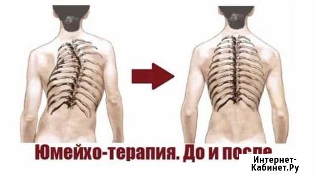 Японский массаж юмейхо Нижний Новгород - изображение 1