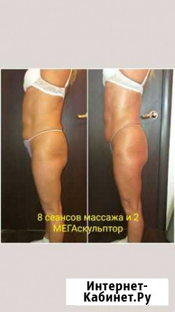 Антицеллюлитный массаж,лифтинг, коррекция фигуры Рязань - изображение 1
