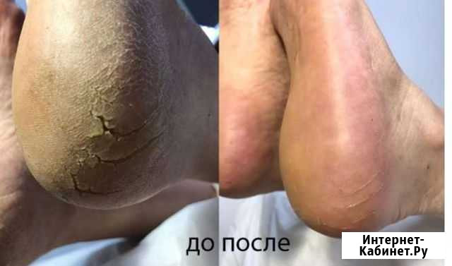 Мужской и женский педикюр Владикавказ - изображение 1