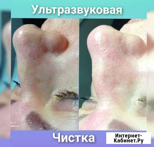Косметология Благовещенск - изображение 1