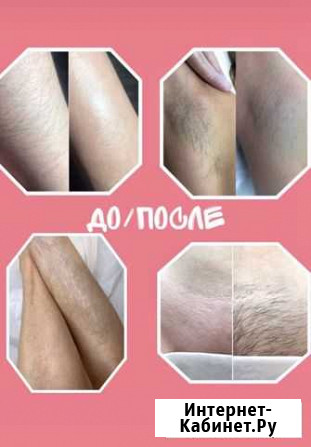 Шугаринг, Эпиляция воском (Мещера) Нижний Новгород - изображение 1