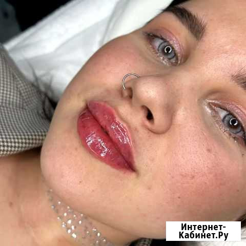 Увеличение губ Брянск - изображение 1