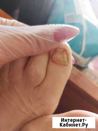 Педикюр на дому Санкт-Петербург - изображение 1