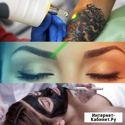 Удаление тату/татуажа лазером + карбоновый пилинг Салехард - изображение 1