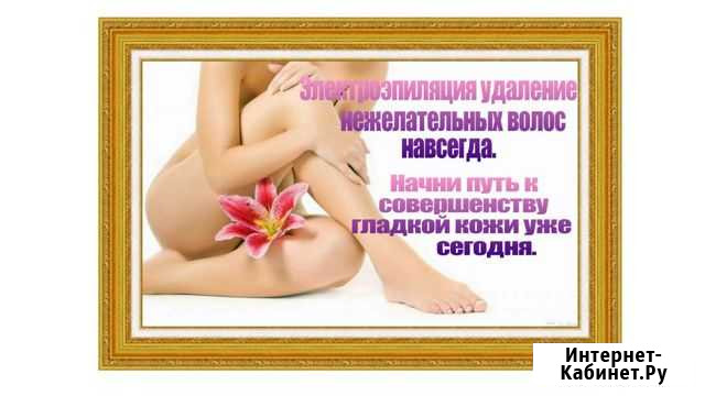 Электроэпиляция Нальчик - изображение 1