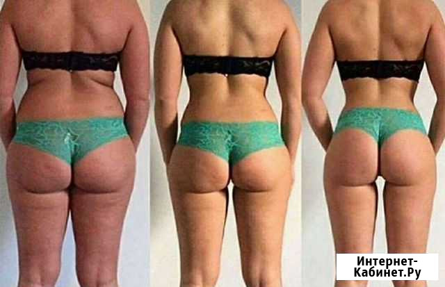 Антицеллюлитный и лимфодренажный массаж Иваново - изображение 1