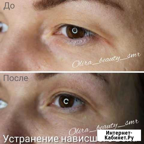 Холодная плазма. Дарим бесплатно зону на выбор Самара - изображение 1