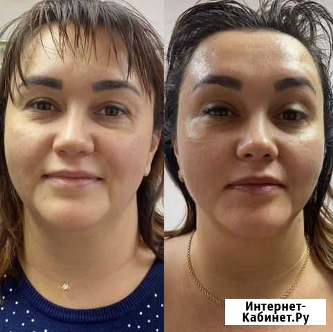 Массаж лица Ухта - изображение 1