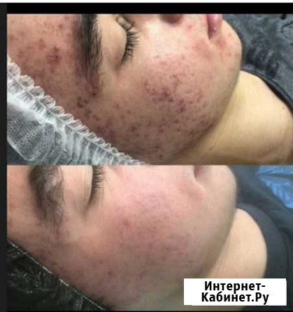 Косметолог Нижний Новгород - изображение 1