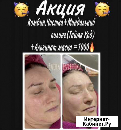 Чистка +Пилинг+Маска Махачкала - изображение 1