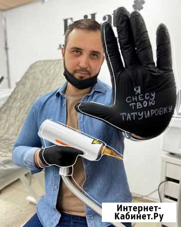 Удаление тату и татуажа Губкин - изображение 1