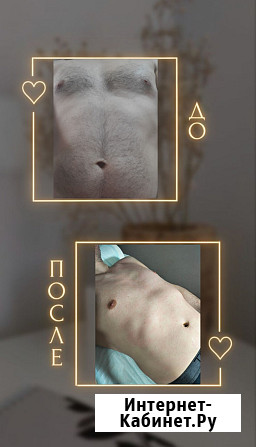 Мужской Мастер Депиляции Казань - изображение 4